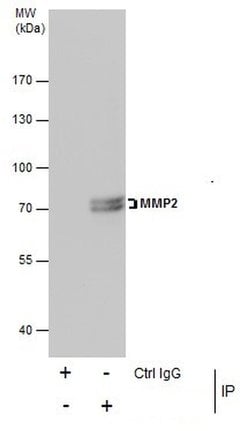 Invitrogen MMP2 Polyclonal Antibody 100 &mu;L; Unconjugated:Antibodies,