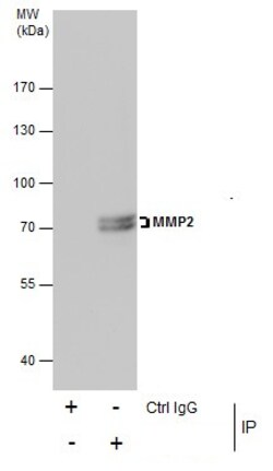 Invitrogen MMP2 Polyclonal Antibody 100 &mu;L; Unconjugated:Antibodies,