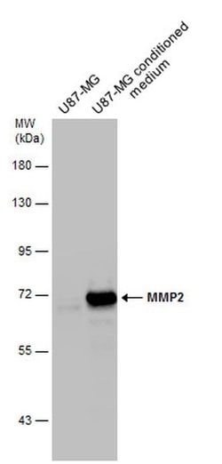Invitrogen MMP2 Polyclonal Antibody 100 &mu;L; Unconjugated:Antibodies,