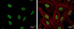 Invitrogen CSB Polyclonal Antibody 100 &mu;L; Unconjugated:Antibodies,