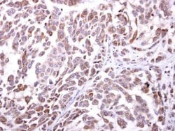 Invitrogen NKG2D Polyclonal Antibody 100 &mu;L; Unconjugated:Antibodies,