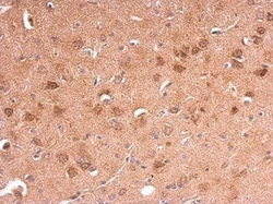 Invitrogen Adiponectin Receptor 1 Polyclonal Antibody 100 &mu;L; Unconjugated:Antibodies,