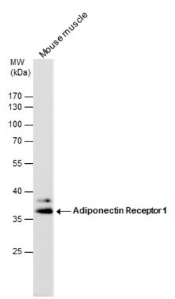 Invitrogen Adiponectin Receptor 1 Polyclonal Antibody 100 &mu;L; Unconjugated:Antibodies,
