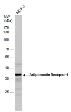 Invitrogen Adiponectin Receptor 1 Polyclonal Antibody 100 &mu;L; Unconjugated:Antibodies,