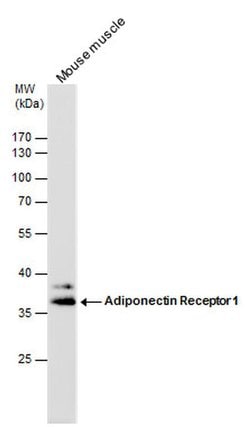 Invitrogen Adiponectin Receptor 1 Polyclonal Antibody 100 &mu;L; Unconjugated:Antibodies,
