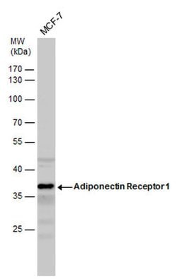 Invitrogen Adiponectin Receptor 1 Polyclonal Antibody 100 &mu;L; Unconjugated:Antibodies,