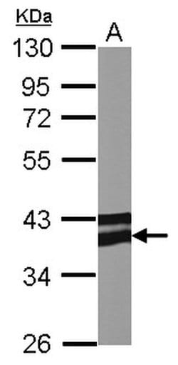 Invitrogen Adiponectin Receptor 1 Polyclonal Antibody 100 &mu;L; Unconjugated:Antibodies,