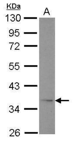 Invitrogen Adiponectin Receptor 1 Polyclonal Antibody 100 &mu;L; Unconjugated:Antibodies,