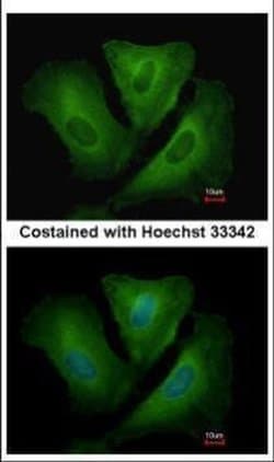 Invitrogen HLA-DRB3 Polyclonal Antibody 100 &mu;L; Unconjugated:Antibodies,