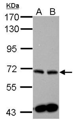 Invitrogen SPHK2 Polyclonal Antibody 100 &mu;L; Unconjugated:Antibodies,