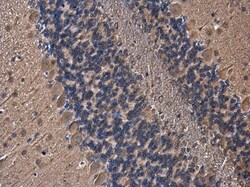 PLCL1 Polyclonal Antibody:Antibodies, Polyclonal