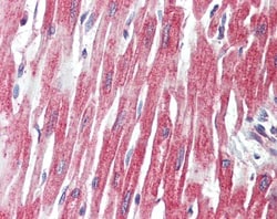 PLCL1 Polyclonal Antibody:Antibodies, Polyclonal