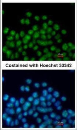 Invitrogen Nkx2.5 Polyclonal Antibody 100 &mu;L; Unconjugated:Antibodies,