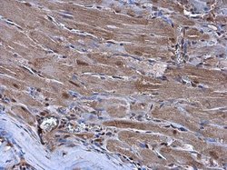 Invitrogen Nkx2.5 Polyclonal Antibody 100 &mu;L; Unconjugated:Antibodies,