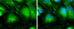 Invitrogen L-Plastin Polyclonal Antibody 100 &mu;L; Unconjugated:Antibodies,