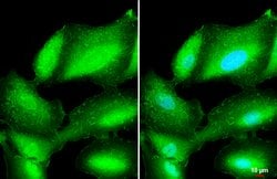 Invitrogen L-Plastin Polyclonal Antibody 100 &mu;L; Unconjugated:Antibodies,