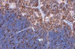 Invitrogen L-Plastin Polyclonal Antibody 100 &mu;L; Unconjugated:Antibodies,
