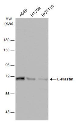 Invitrogen L-Plastin Polyclonal Antibody 100 &mu;L; Unconjugated:Antibodies,