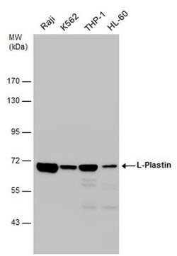 Invitrogen L-Plastin Polyclonal Antibody 100 &mu;L; Unconjugated:Antibodies,