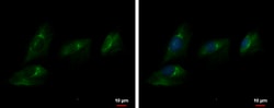 Invitrogen&trade;&nbsp;ENPP2 Polyclonal Antibody