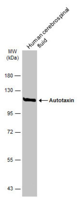 Invitrogen ENPP2 Polyclonal Antibody 100 &mu;L | Buy Online | Invitrogen&trade; | Fisher Scientific
