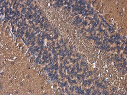 Invitrogen AKAP10 Polyclonal Antibody 100 &mu;L; Unconjugated:Antibodies,