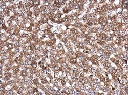 Invitrogen AKAP10 Polyclonal Antibody 100 &mu;L; Unconjugated:Antibodies,
