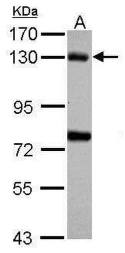 Invitrogen Bub1 Polyclonal Antibody 100 &mu;L; Unconjugated:Antibodies,