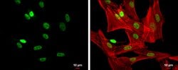 Invitrogen FOXP3 Polyclonal Antibody 100 &mu;L; Unconjugated:Antibodies,