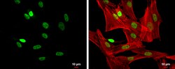 Invitrogen FOXP3 Polyclonal Antibody 100 &mu;L; Unconjugated:Antibodies,