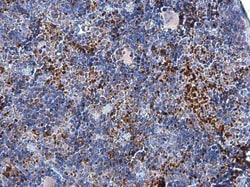 Invitrogen FOXP3 Polyclonal Antibody 100 &mu;L; Unconjugated:Antibodies,
