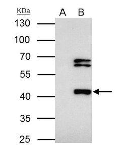Invitrogen FOXP3 Polyclonal Antibody 100 &mu;L; Unconjugated:Antibodies,
