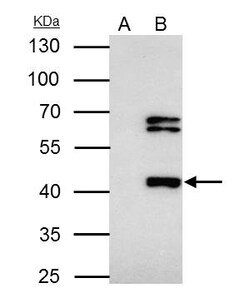 Invitrogen FOXP3 Polyclonal Antibody 100 &mu;L; Unconjugated:Antibodies,
