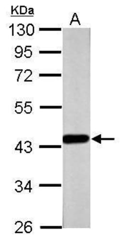 Invitrogen FOXP3 Polyclonal Antibody 100 &mu;L; Unconjugated:Antibodies,