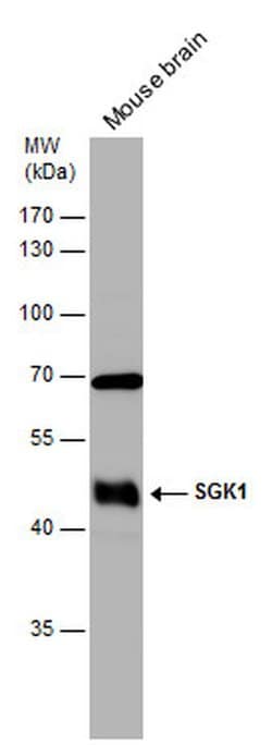 SGK1 Polyclonal Antibody, Invitrogen 100 &mu;L; Unconjugated:Antibodies,