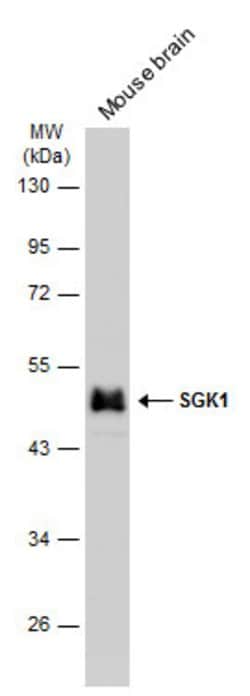 SGK1 Polyclonal Antibody, Invitrogen 100 &mu;L; Unconjugated:Antibodies,