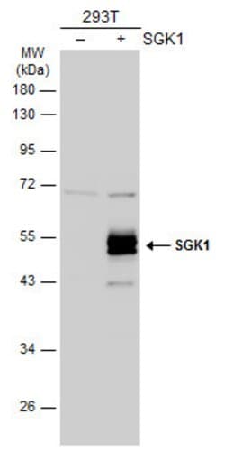 SGK1 Polyclonal Antibody, Invitrogen 100 &mu;L; Unconjugated:Antibodies,