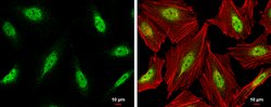 CDK9 Polyclonal Antibody, Invitrogen 100 &mu;L; Unconjugated:Antibodies,