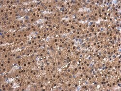 CDK9 Polyclonal Antibody, Invitrogen 100 &mu;L; Unconjugated:Antibodies,