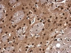 CDK9 Polyclonal Antibody, Invitrogen 100 &mu;L; Unconjugated:Antibodies,