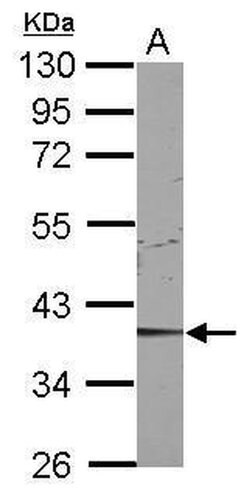 CDK9 Polyclonal Antibody, Invitrogen 100 &mu;L; Unconjugated:Antibodies,