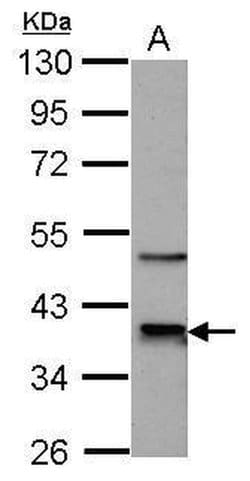 CDK9 Polyclonal Antibody, Invitrogen 100 &mu;L; Unconjugated:Antibodies,