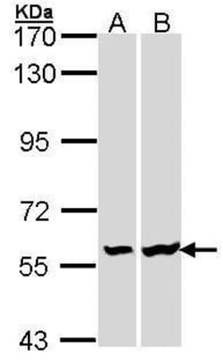 Invitrogen LCK Polyclonal Antibody 100 &mu;L; Unconjugated:Antibodies,