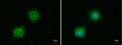 Invitrogen PINK1 Polyclonal Antibody 100 &mu;L; Unconjugated:Antibodies,