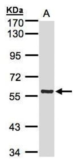 Invitrogen PINK1 Polyclonal Antibody 100 &mu;L; Unconjugated:Antibodies,