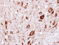 Invitrogen GRK2 Polyclonal Antibody 100 &mu;L; Unconjugated:Antibodies,