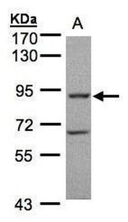 Invitrogen GRK2 Polyclonal Antibody 100 &mu;L; Unconjugated:Antibodies,