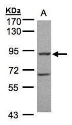 Invitrogen GRK2 Polyclonal Antibody 100 &mu;L; Unconjugated:Antibodies,