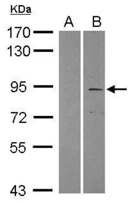 Invitrogen TRIM2 Polyclonal Antibody 100 &mu;L; Unconjugated:Antibodies,