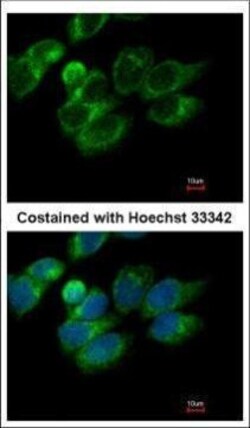 Invitrogen PRDX4 Polyclonal Antibody 100 &mu;L; Unconjugated:Antibodies,